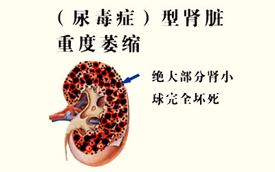 正常情况下,cys c在血清和血浆中的浓度为051~109mgl 参考范围肌酐cre