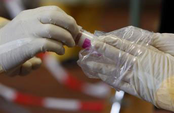 法国研究人员研制出了只用15分钟就知晓结果的埃博拉病毒快速检测法