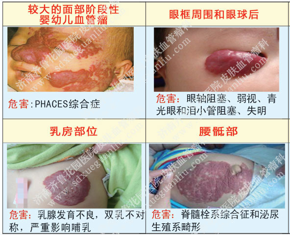 沿ϴѪѪȲƻɵΣͼƬ