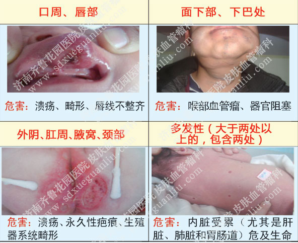 ڴҸѲϵѪƻɵΣͼƬ