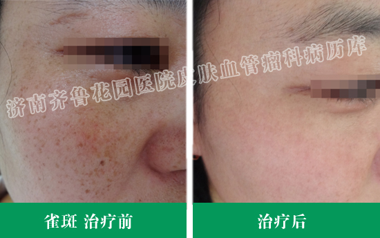 Ժȸ߻öݼۺƳɹǰԱƬ