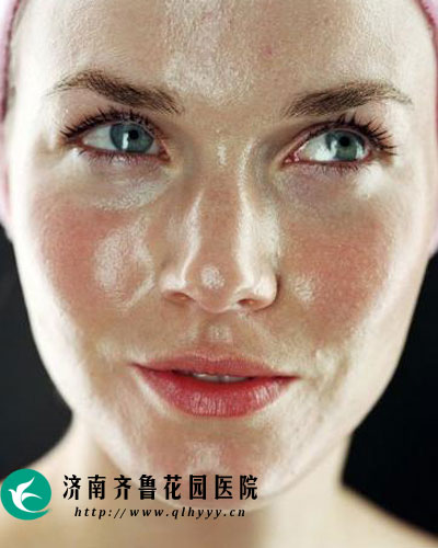 夏季皮肤爱出油 如何才能告别油腻_济南齐鲁花
