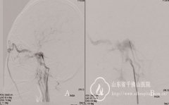 ɽʡǧɽҽԺһĤ֧ܾڶ