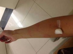 ݡ���Ⱦ����ô���ƱȽϺ�