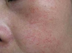 ���ƺ�Ѫ˿Ҫ����Ǯ �����ַ�����ʵ��