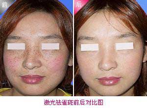 ûпȥȸ߲ķQǲܹȥȸߣϸĹЧQȥȸߵĹʹֻ࣬Ҫ÷ɹͱʪɡ