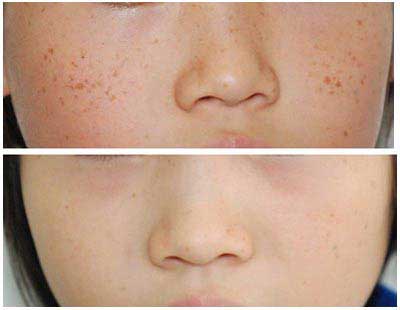 ȸߵЧòãԺȸ߲õļ豸ĿǰΪȽһֵQǣȸѡ񼤹ҩۺƷǲȸߵЧƽۺȫ