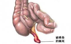 13-1406060S544917-lp.jpg