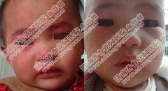 ����������̥����Ҫ������