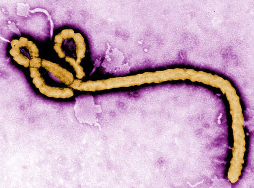 埃博拉病毒实验室高倍显微镜下活体图