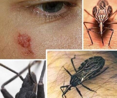 ×¶³æ²¡·ÖΪ·ÇÖÞ×¶³æ²¡ºÍÃÀÖÞ×¶³æ²¡£¬ÊÇ·Ö±ðÓɲɲÉÓ¬ºÍ×¶òí(Ë׳Ƴô³æ)´«²¥µÄÈËÐó¹²»¼¼ÄÉú³æ²¡