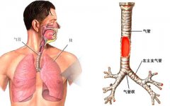 支气管炎医院排名_支气管炎医院证明(2)
