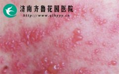 ��״�����������ʲôΣ���᲻�ᴫȾ