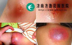 14-1501091G155443-lp.jpg