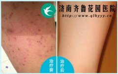 �ֱ��ϵ���ë������ʲôԭ���������ô���ƺ�