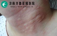 ݡ�����ƽʱҪע��ʲô