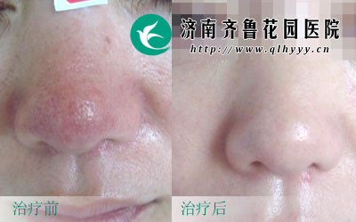 Ӱ沿ۣˣּǧҪ⣬ôǵγԭ֢״Щأһ˾κá