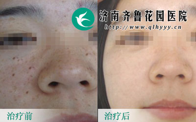 ȸ߲òܴӰ죬Ӱ컼ߵЩȺôȸӦôأȸȥ