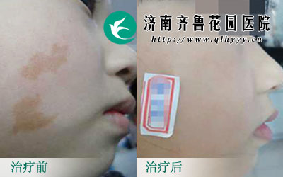 Ȱ߶Իߵò˺ܴӰ죬ôϵĿȰôȥأרұʾĿǰƿȰѵѡ񷽷