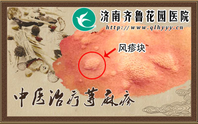 风疹和荨麻疹的区别图,风疹的症状图片,风疹(第4页)_大山谷图库