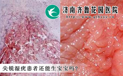 ʪһԴܶŮԻ߳ǵмʪ⣬һ˽⼰ʪ໼עЩ