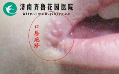 ��������������Щ֢״�ص�