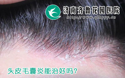 ͷƤëκë׵ΣЩë׿ܶಿλͷͷƤë׵֢״Уŧ׵ȡ