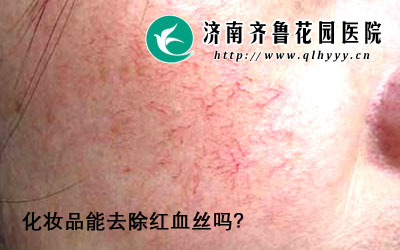 红血丝虽然是一种很常见的现象,但是对患者朋友的外貌美观产生的影响很大,那么,红血丝的形成原因是什么呢,化妆品能去除红血丝吗。