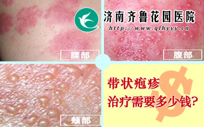 ״ҪǮ״Ʒɶ෽ؾģƼԭ򼰲̶ȵȣô״ĻЩء