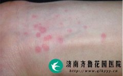 ݡ�����Ǵ�Ⱦ��Ƥ������