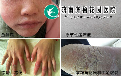 色素沉着是什么原因引起 14-1512031ASX25.jpg