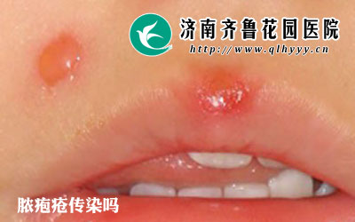 14-15122Q6420E30.jpg