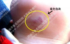 �ճ����ı��������ϳ���ɫ���鲻֪��ʲô