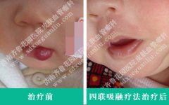 �����촽������һ��С�춹�����ϻ���