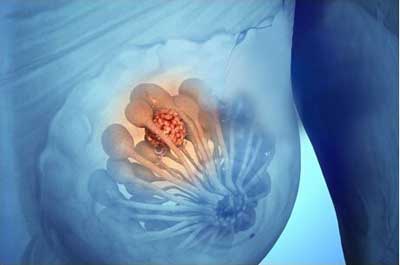 怎么样才可以不长胸 1-1604151KR1152.jpg