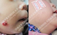 �����е���Щ�˸����׻���Ѫ����