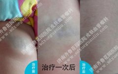 ������Ȳ�ͬ�ĺ���״Ѫ��������Щ��ͬ��֢״����