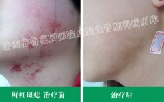 ���ϵĺ�̥��ֻ��ҩ�����ƿ��Գ���ȥ����