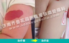 �����ĸ첲�ϵĺ�ӡ���б�Ҫȥ����