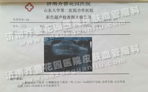 左侧腰部皮下探查