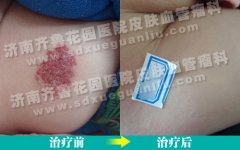 ����9���´󱦱����Ȳ���ɫ��Ƭ���ƿ�������