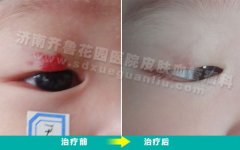 ���Ʊ�����Ƥ�ϵĺ��Ƭ��ҩ��ûЧ��������������