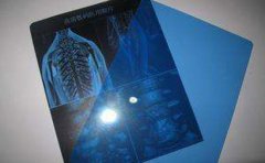 ҽԺƳƵӽƬ һΰøĸʵ