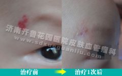 üͷϵĺߵҩˮͿĨûЧô