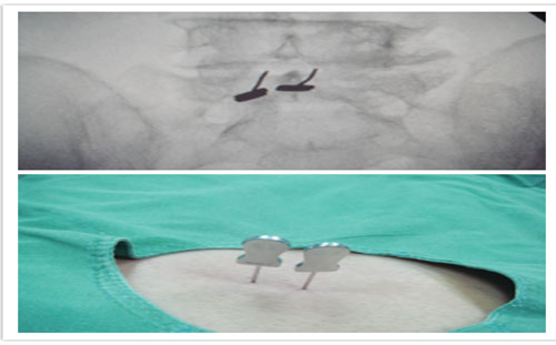 ɽѧڶҽԺչC׵խ֢΢򿪷ʩ