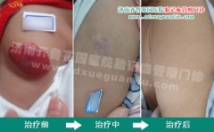 ֱϵĺߵһûгҪȥҽԺ