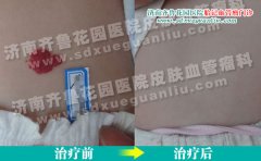 ϵĺʪҩˮһºΪʲô