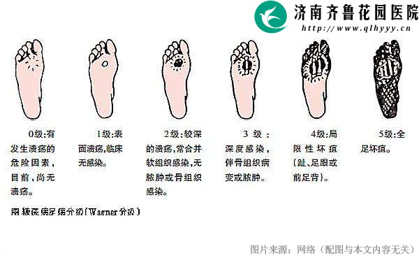 20-1Z329152S0332.jpg