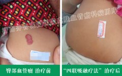 ƨϵĺ߿˿ڳСŪʪô