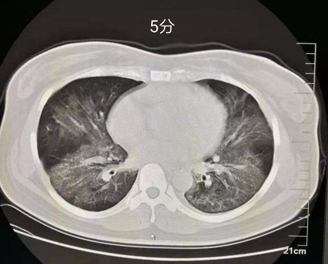 ˫Ĥ෢Ƭ״ĥܶӰ߽ɶڣڣݱΪƬʵաά